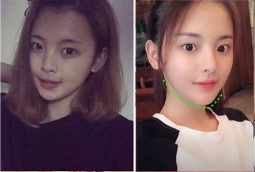 成人下巴抖动视频,视频解析背后的原因与应对策略