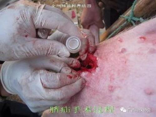 成人脐疝手术图片视频,图片与视频详解