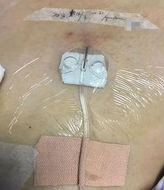 成人害怕扎针吗视频讲解,揭秘成人对扎针恐惧的深层原因 第3张 成人害怕扎针吗视频讲解,揭秘成人对扎针恐惧的深层原因 第3张